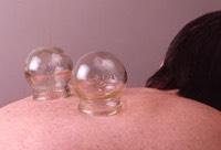 cupping