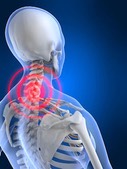 neck pain skeleton